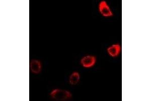 Image no. 2 for anti-Neuroglobin (NGB) antibody (ABIN3197739)