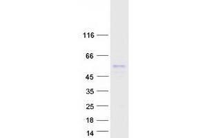 Image no. 1 for RNA-Binding Protein S1 (RNPS1) (Transcript Variant 2) protein (Myc-DYKDDDDK Tag) (ABIN2731057)