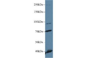 Image no. 3 for anti-Fibroblast Growth Factor Receptor 2 (FGFR2) (AA 157-377) antibody (ABIN1858879)