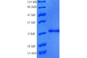 NUP210 Protein (AA 28-238, partial) (His tag)