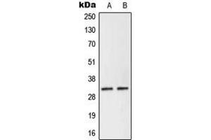 Image no. 1 for anti-Neuralized Homolog 2 (NEURL2) (Center) antibody (ABIN2706669)