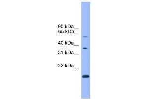 Image no. 1 for anti-Notch 4 (NOTCH4) (C-Term) antibody (ABIN2780608)