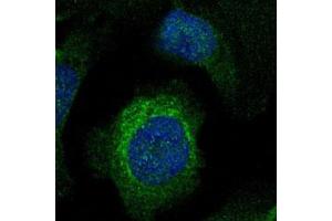 Image no. 1 for anti-LIM and Calponin Homology Domains 1 (LIMCH1) antibody (ABIN5582579)