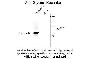 anti-Glycine Receptor (GRD) (N-Term) antibody