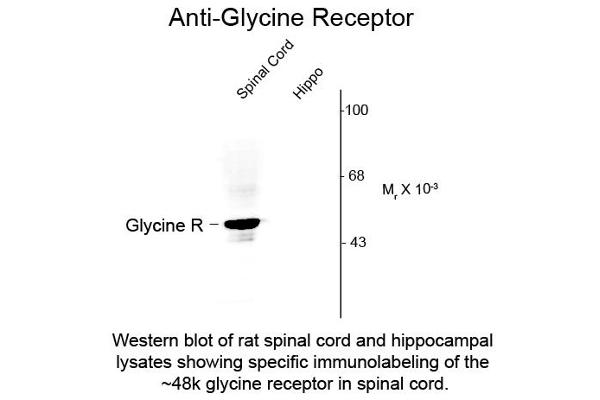 anti-Glycine Receptor (GRD) (N-Term) antibody