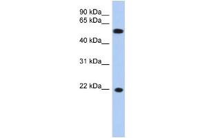 Image no. 1 for anti-Crystallin, gamma C (CRYGC) (Middle Region) antibody (ABIN2774014)