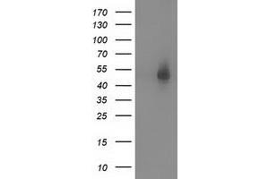 Image no. 3 for anti-Syntrophin, alpha 1 (Dystrophin-Associated Protein A1, 59kDa, Acidic Component) (SNTA1) antibody (ABIN1501028)