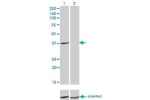 anti-Alcohol Dehydrogenase 4 (Class II), pi Polypeptide (ADH4) (AA 52-150) antibody