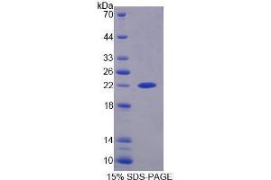 ERCC6 Protein (AA 843-1002) (His tag)