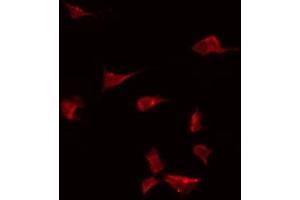 Image no. 2 for anti-Bone Morphogenetic Protein 10 (BMP10) antibody (ABIN6256960)