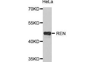 Image no. 1 for anti-Renin (REN) antibody (ABIN3022188)