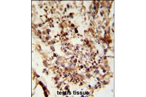 Image no. 2 for anti-Achaete-scute complex protein T5 (AC) (AA 387-416), (C-Term) antibody (ABIN5530382)