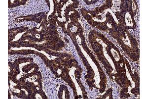 Image no. 2 for anti-P53 and DNA-Damage Regulated 1 (PDRG1) (AA 1-133) antibody (ABIN2692773)