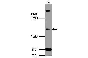 Image no. 1 for anti-Cyclin-Dependent Kinase 13 (CDK13) (Center) antibody (ABIN2855387)
