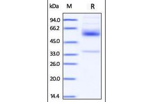 Image no. 1 for CD79b Molecule, Immunoglobulin-Associated beta (CD79B) (AA 29-159) protein (Fc Tag) (ABIN2180837)