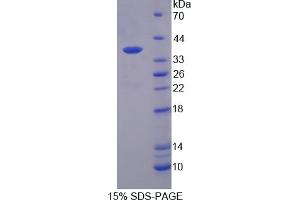 Image no. 1 for Interleukin 12 beta (IL12B) (AA 23-329) protein (His tag) (ABIN6236549)