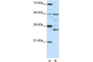Image no. 1 for anti-Forkhead Box N2 (FOXN2) (N-Term) antibody (ABIN2780405)