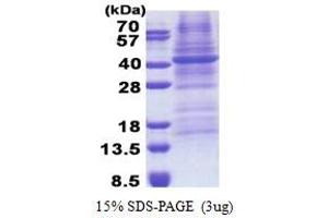 Image no. 1 for Fucosyltransferase 3 (Galactoside 3(4)-L-Fucosyltransferase, Lewis Blood Group) (FUT3) (AA 35-361) protein (His tag) (ABIN5853233)