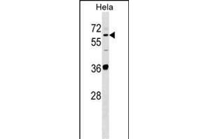 SUOX Antibody (Center) (ABIN1537904 and ABIN2848703) western blot analysis in Hela cell line lysates (35 μg/lane).