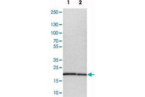 Image no. 3 for anti-Mannose-P-Dolichol Utilization Defect 1 (MPDU1) antibody (ABIN5583690)