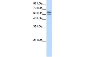 Image no. 3 for anti-Nucleus Accumbens Associated 1, BEN and BTB (POZ) Domain Containing (NACC1) (C-Term) antibody (ABIN2778437)