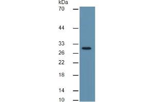 Image no. 3 for Carbonic Anhydrase II (CA2) ELISA Kit (ABIN6574206)