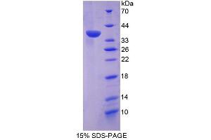 Image no. 1 for Dual Specificity Phosphatase 6 (DUSP6) (AA 1-300) protein (S tag,His tag) (ABIN6237143)