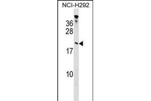 TP Antibody (Center) (ABIN1538440 and ABIN2848728) western blot analysis in NCI- cell line lysates (35 μg/lane).