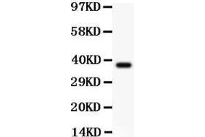 Image no. 2 for anti-NLR Family, Pyrin Domain Containing 3 (NLRP3) (AA 21-194) antibody (ABIN3043571)