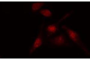 Image no. 1 for anti-Activating Transcription Factor 1 (AFT1) (Internal Region) antibody (ABIN6256913)