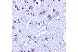 Image no. 1 for anti-TP53 induced glycolysis regulatory phosphatase (TIGAR) (Internal Region) antibody (ABIN6655743)