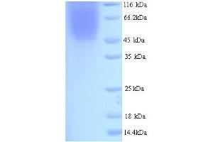 Image no. 1 for Indoleamine 2,3-Dioxygenase 1 (IDO1) (AA 1-403), (full length) protein (His tag) (ABIN5713520)