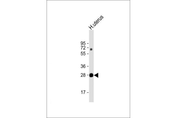 VGLL4 抗体  (AA 136-163)