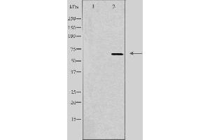 Image no. 1 for anti-TAF5-Like RNA Polymerase II, P300/CBP-Associated Factor (PCAF)-Associated Factor, 65kDa (TAF5L) antibody (ABIN6258336)