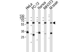 Image no. 3 for anti-Pyruvate Kinase M2 (PKM2) (AA 476-505), (C-Term) antibody (ABIN391053)