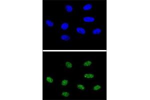 Image no. 2 for anti-Peptidylprolyl Cis/trans Isomerase, NIMA-Interacting 1 (PIN1) (AA 30-56) antibody (ABIN3028920)