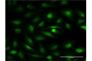 Image no. 2 for anti-Zinc Finger and BTB Domain Containing 7A (ZBTB7A) (AA 1-108) antibody (ABIN949311)