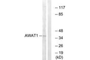 Image no. 1 for anti-Acyl-CoA Wax Alcohol Acyltransferase 1 (AWAT1) (AA 261-310) antibody (ABIN1534595)