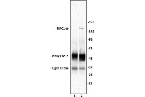 Image no. 3 for anti-Structural Maintenance of Chromosomes 1A (SMC1A) (C-Term) antibody (ABIN6972754)