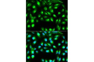 Image no. 6 for anti-Gem (Nuclear Organelle) Associated Protein 2 (GEMIN2) antibody (ABIN3017339)
