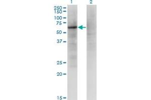 Western Blot analysis of ZNF34 expression in transfected 293T cell line by ZNF34 monoclonal antibody (M03), clone 1B11.