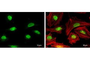 ICC/IF Image Rad51 antibody [N1C2] detects Rad51 protein at nucleus by immunofluorescent analysis.