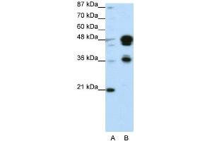 Image no. 6 for anti-Forkhead Box A1 (FOXA1) (C-Term) antibody (ABIN2779762)