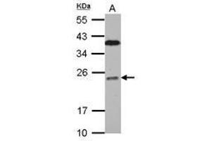 Image no. 2 for anti-B-Cell CLL/lymphoma 7C (BCL7C) (AA 1-215) antibody (ABIN1496855)