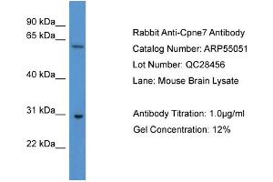 Image no. 2 for anti-Copine VII (CPNE7) (C-Term) antibody (ABIN2786028)