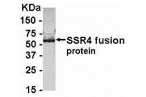 Image no. 1 for anti-Signal Sequence Receptor, delta (SSR4) (AA 61-130) antibody (ABIN2468174)