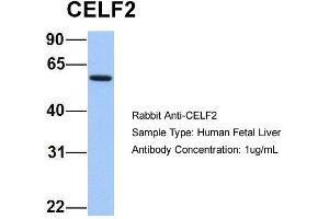 Image no. 4 for anti-CUGBP, Elav-Like Family Member 2 (CELF2) (N-Term) antibody (ABIN2778746)