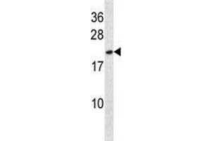 Image no. 1 for anti-High Mobility Group Box 3 (HMGB3) (AA 50-79) antibody (ABIN3028706)