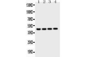 Image no. 2 for anti-Cathepsin D (CTSD) (AA 65-410) antibody (ABIN3042775)
