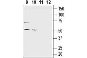 Western blot analysis of mouse colon (lanes 9 and 11) and human colorectal adenocarcinoma (Colo 205) cell line (lanes 10 and 12) lysates: - 9,10.